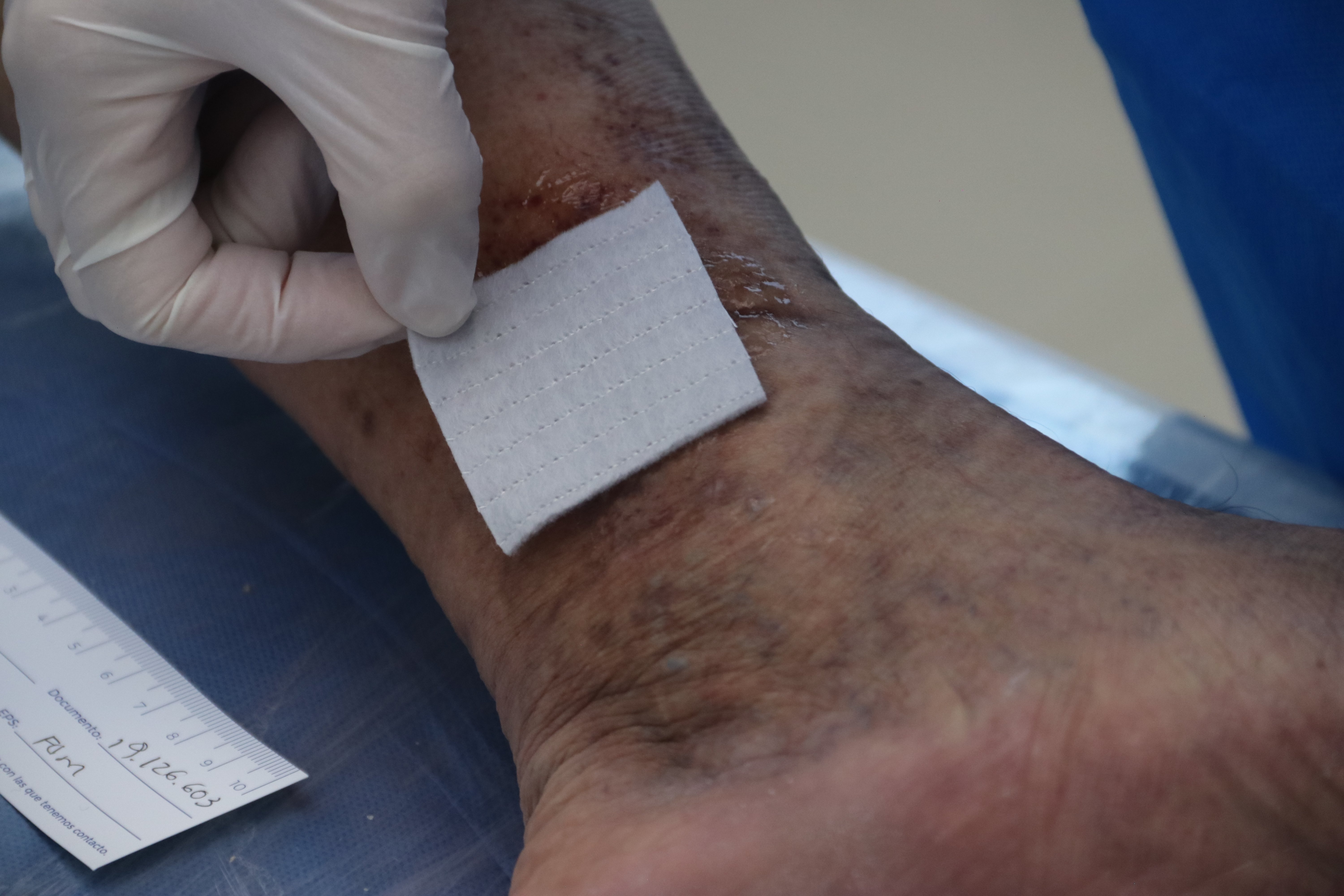 a close-up of a dressing on a wound