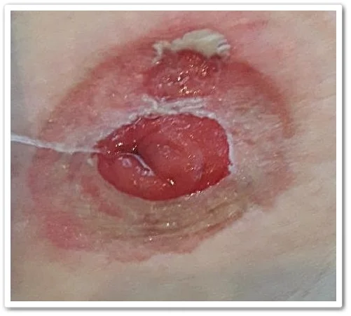 zbliżenie ust osoby łyżką