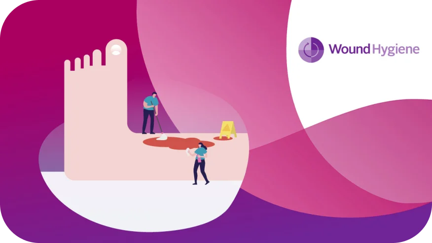 Wound Hygiene - Improving the patient's leg by cleaning and removing the biofilm